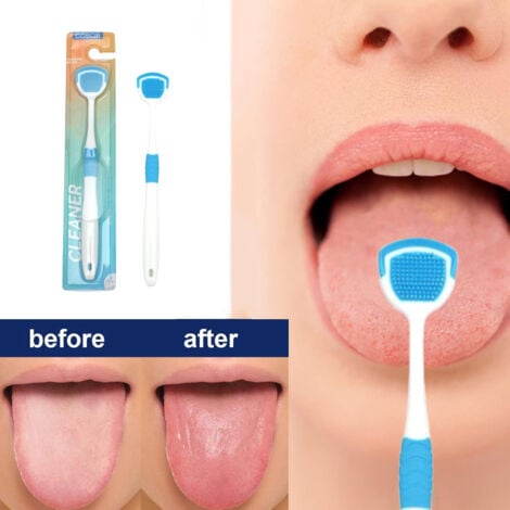 Soft Tongue Scraper | Gentle & Effective Cleaning